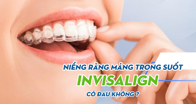 Niềng răng trong suốt Invisalign có đau không?